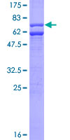 12.5% SDS-PAGE Stained with Coomassie Blue.